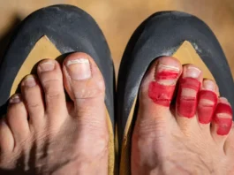 Close-up comparing a snug versus painful climbing shoe fit on a climber's foot to get the fit right.