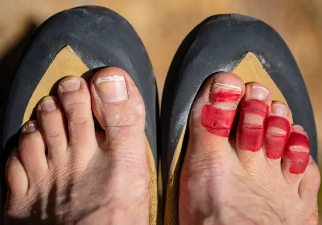 Close-up comparing a snug versus painful climbing shoe fit on a climber's foot to get the fit right.