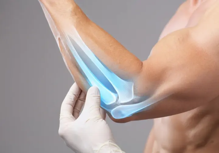 Understanding causes and anatomy of elbow pain: close-up of an elbow with anatomical details relevant to elbow pain from rock climbing.